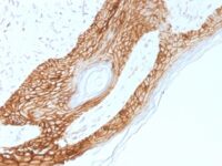 FFPE human skin sections stained with 100 ul anti-E-Cadherin / CD324 (clone 4A2) at 1:50. HIER epitope retrieval prior to staining was performed using 10mM Citrate, pH 6.0.